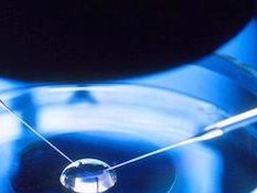 湖北市哪些医院提供试管婴儿服务？选择湖北市试管婴儿医院依据是什么？湖北市哪家医院的试管婴儿成功率高？