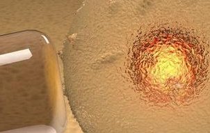 深度解析：泰国第三代试管婴儿可靠吗？实现生育梦想的捷径！